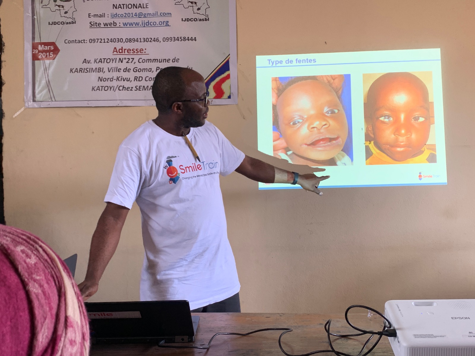 Formation par l'Hôpital CBCA NDOSHO/BETHESDA sur la sensibilisation et la sélection des cas de fente labiale et fente palatine.